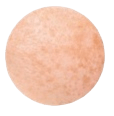 Enlarged Pore Tissue